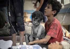 روایت الجزیره از وضعیت سخت کودکان مبتلا به سوء تغذیه غزه