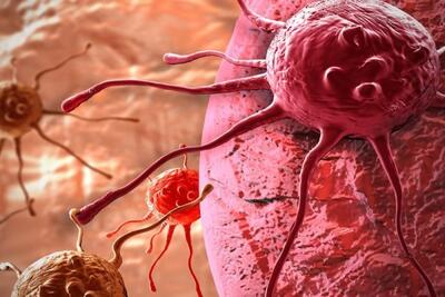 تاثیر ترکیب بادرنجبویه ونانو نقره-گرافن در مهار سلول‌های سرطانی