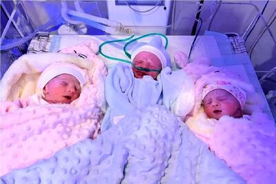 نوزادان سه قلو تحت درمان در آباده فارس متولد شدند