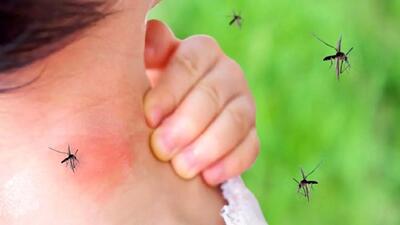 تب دنگی در کودکان: نکات مهمی که باید بدانید