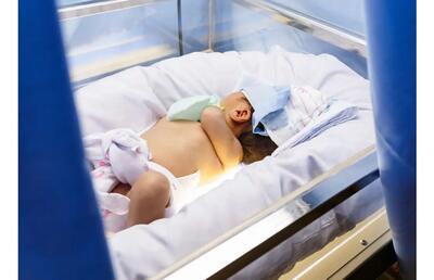 اجاره دستگاه زردی نوزاد (فتوتراپی) از دیوار، راه حلی نامطمئن برای درمان زردی!