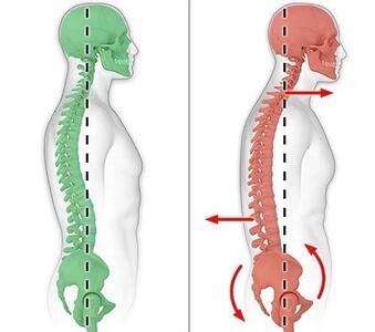 اصول پیاده روی برای لاغری و راز های مهمی که نمی دانید.