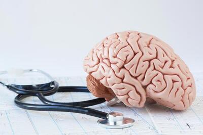 به ۲ دلیل ۴ برابر بیشتر در معرض سکته‌های مغزی هستید | ۵ اقدام ساده برای سلامت مغز