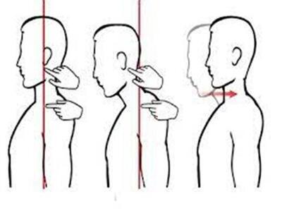 چند حرکت اصلاحی برای درمان قوز گردن | پایگاه خبری تحلیلی انصاف نیوز