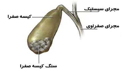 معجونی برای صفرا زدایی + فیلم