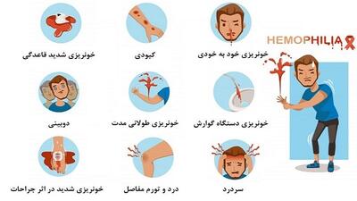 ۱۴۰۰۰ بیمار هموفیلی در کشور