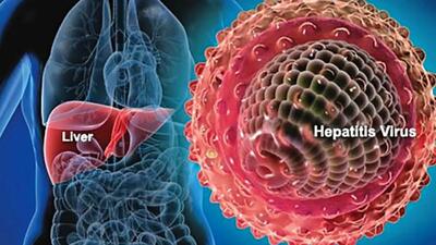 ایران تا 7 سال دیگر از هپاتیت C پاک می‌شود