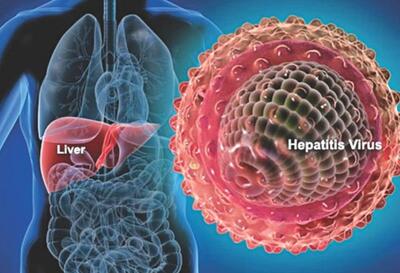 حذف هپاتیت C تا ۱۴۱۰ در ایران/ اجرای برنامه بیماریابی