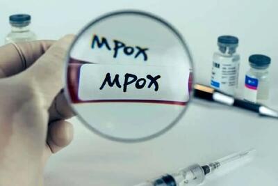 بیماری آبله میمون یا ویروس Mpox چیست ؟ / هر آنچه باید درباره ویروس Mpox بدانید