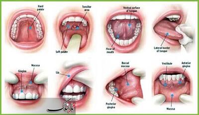 بالا رفتن خطر ابتلا به «سرطان دهان» بر اثر مصرف سیگار و قلیان