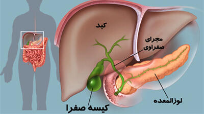 لوزالمعده چیست؟