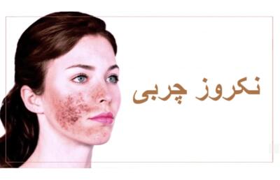 نکروز چربی چیست و چگونه درمان می‌شود؟