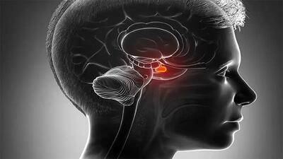آسیب به آمیگدال چه عوارضی دارد؟