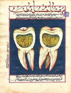 درد دندان بدلیل جن زدگی!