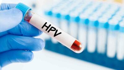 صفر تا صد آنچه که باید در مورد ویروس Hpv بدانید