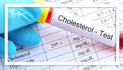 علت کلسترول بالا در افراد لاغر