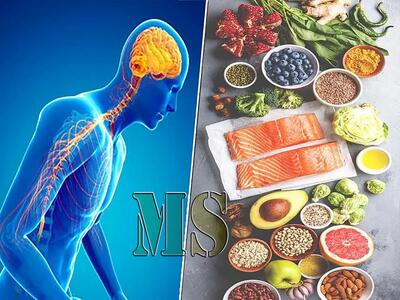 درمان ام اس چیست؟| بیشتر بدانید!