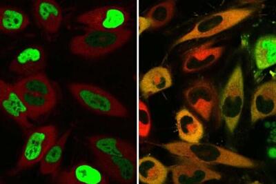 ابداع شیوه جدید برای جانمایی مجدد پروتئین‌ها در سلول‌ها