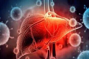 این عادت ها منجر به سرطان کبد می‌شود