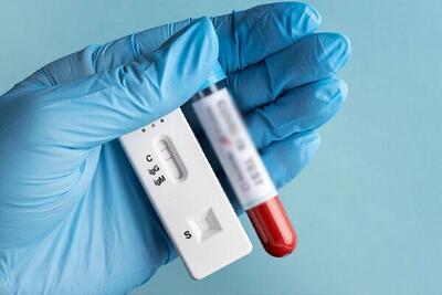 فناوری تولید کیت‌های تشخیص HIV توسعه می‌یابد - اکونیوز