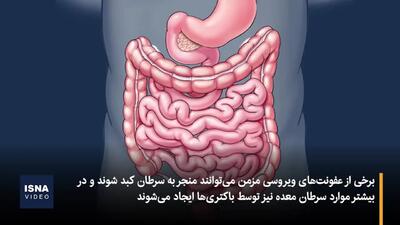 ببینید / شایع‌ ترین عوامل بروز سرطان چیست؟