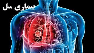 تشخیص و درمان بیماری سِل رایگان است