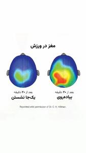 هنگام ورزش چه تغییراتی در مغز رخ می دهد؟ + فیلم