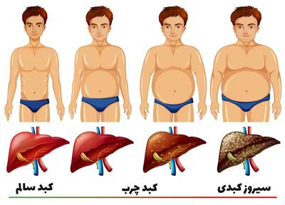 این نوشیدنی ها برای کبد چرب مضره!