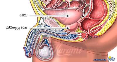 بیماری پروستات چیست و راه‌های درمان آن کدامند؟ | روزنو