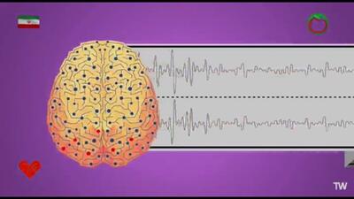 درباره بیماری صرع بیشتر بدانید + فیلم