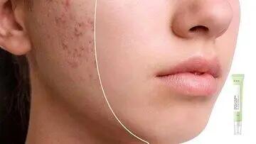 چند مواد غذایی عالی برای حفظ سلامت پوست