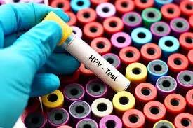 شیوع بالای HPV در پایتخت!