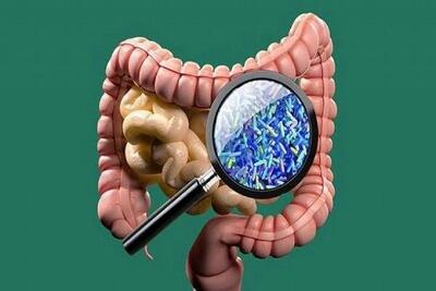 دلیل افزایش ابتلا به سرطان روده بزرگ در جوانان