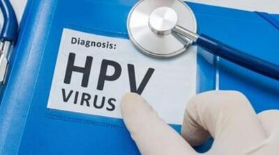 شیوع بالای HPV در تهران!/ واکنش معاون وزیر بهداشت - مردم سالاری آنلاین