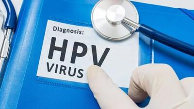 شیوع بالای HPV در تهران!/ واکنش معاون وزیر بهداشت