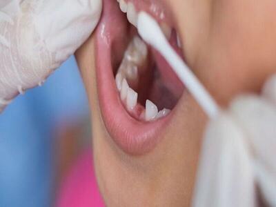 طرح فلورایدتراپی دندان‌های ۸۰۰ هزار دانش آموز خراسان رضوی در حال اجراست