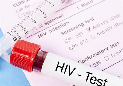 بیش از ۲۴۰۰۰ بیمار HIV در ایران وجود دارد