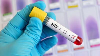 HIV؛ بیماری عفونی و قابل کنترل/ الگوی انتقال بیشتر از طریق روابط جنسی است