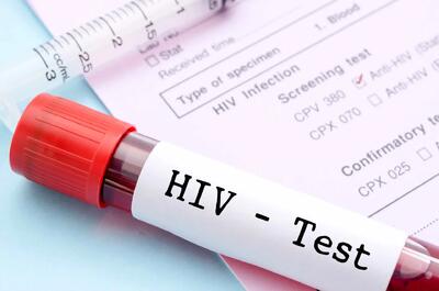 HIV امروز مخصوص گروه خاصی نیست