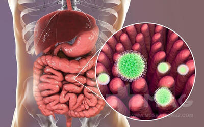 زنگ خطر: شیوع یک ویروس گوارشی جدید با علائم مشابه آنفلوآنزا