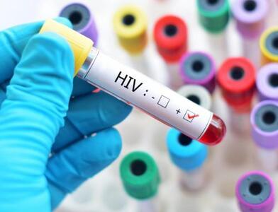 تغییر الگوی انتقال HIV/بیش از 44 هزارنفر اچ‌آی‌وی مثبت هستند