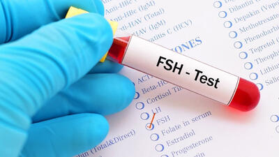 fsh در آزمایش خون چیست؟