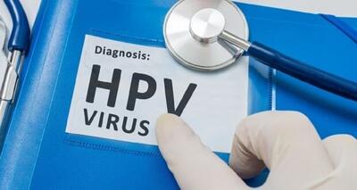 وزارت بهداشت: شیوع بیماری HPV از ۵ % تا بالای ۵۰ % گزارش شده است - پایگاه خبری مدارا