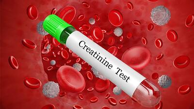 creatinine کراتینین چیست؟ + جدول