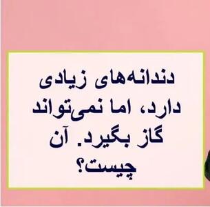 چیستان روز | آن چیست که دندانه‌های زیادی دارد، اما نمی‌تواند گاز بگیرد؟