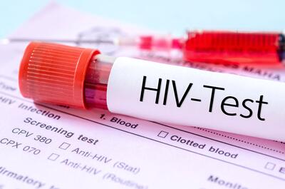 3 راه انتقال HIV/ اولین کار ویروس ایدز بعد از ورود به بدن