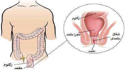 شقاق چیست؟ / جداول مرتبط با شقاق