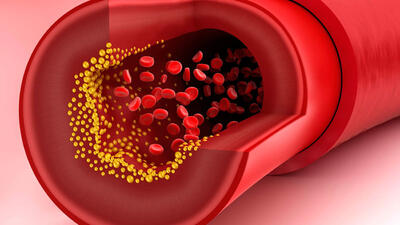 triglycerides تری گلیسرید چیست ؟ + جدول عملکرد اصلی تری گلیسرید