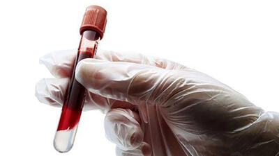 hemoglobin در آزمایش خون چیست؟ + دلایل انجام آزمایش هموگلوبین