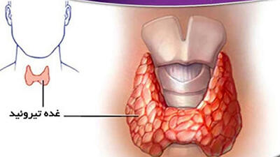 تیروئید چیست و چه علائمی دارد؟ / جدول های کامل درباره پرکاری و کم کاری تیروئید